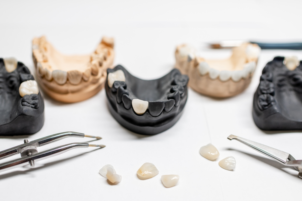 What is a Dental Crown?