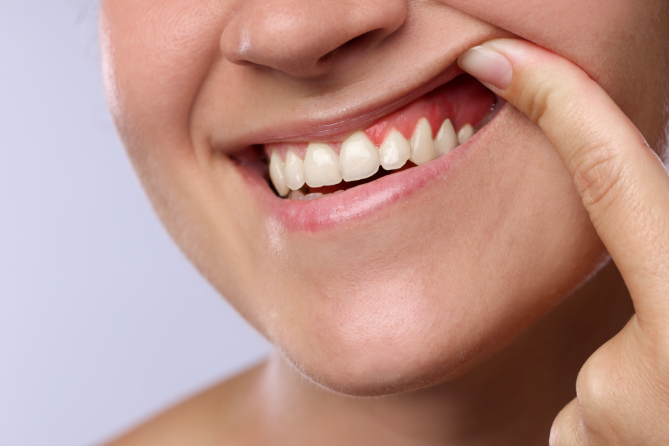 How to Stop Receding Gums From Getting Worse